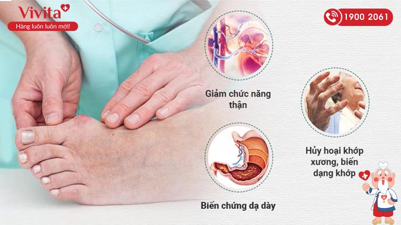 Các biến chứng nguy hiểm từ Gout