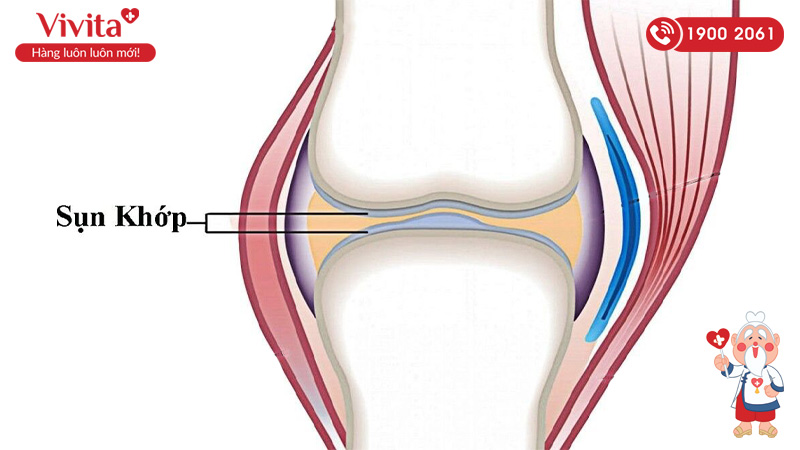 Các khớp di chuyển nhẹ cho phép một số chuyển động nhưng cung cấp ít ổn định hơn các khớp bất động