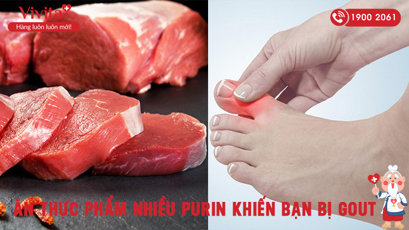 nguyên nhân thường gặp gây nên bệnh gout