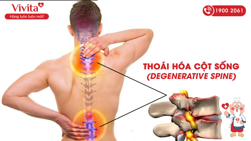 Bệnh thoái hoá cột sống có tên tiếng Anh là Degenerative spine