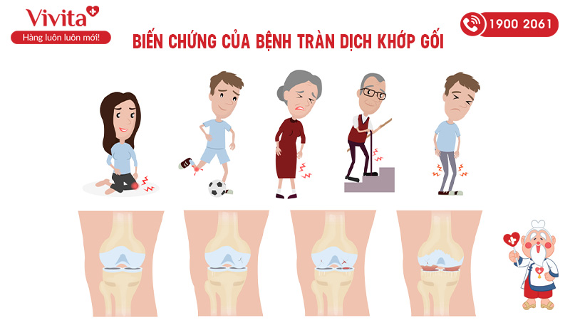 Biến chứng của bệnh tràn dịch khớp gối