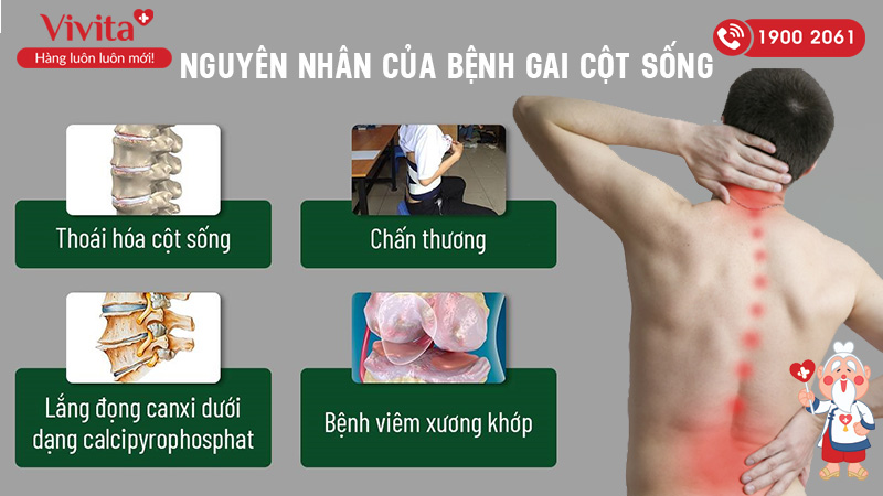 Nguyên nhân của bệnh gai cột sống