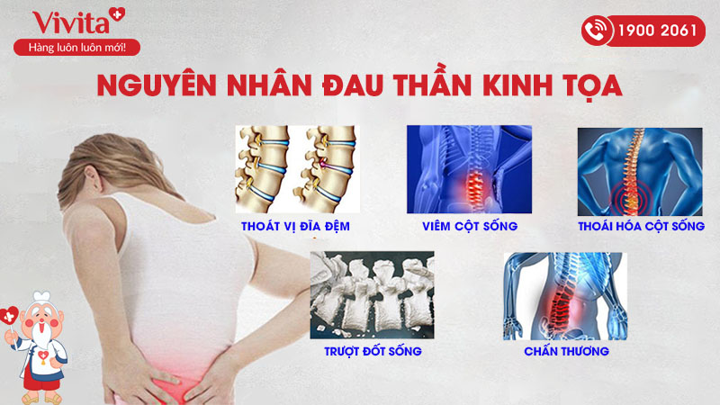 nguyên nhân đau thần kinh tọa