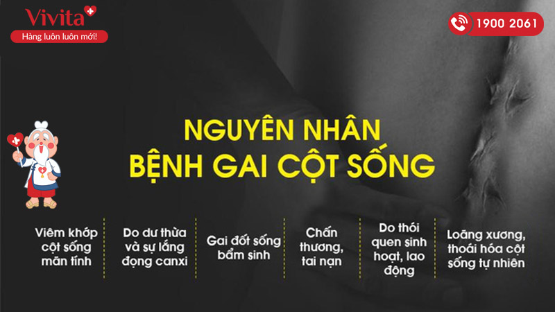 Nguyên nhân gây bệnh gai cột sống