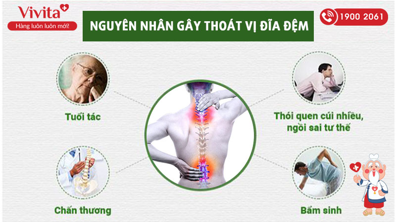 nguyên nhân gây bệnh thoát vị đĩa đệm 