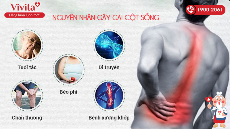 Nguyên nhân gây gai cột sống