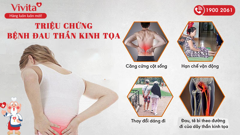 Triệu chứng bệnh đau thần kinh tọa