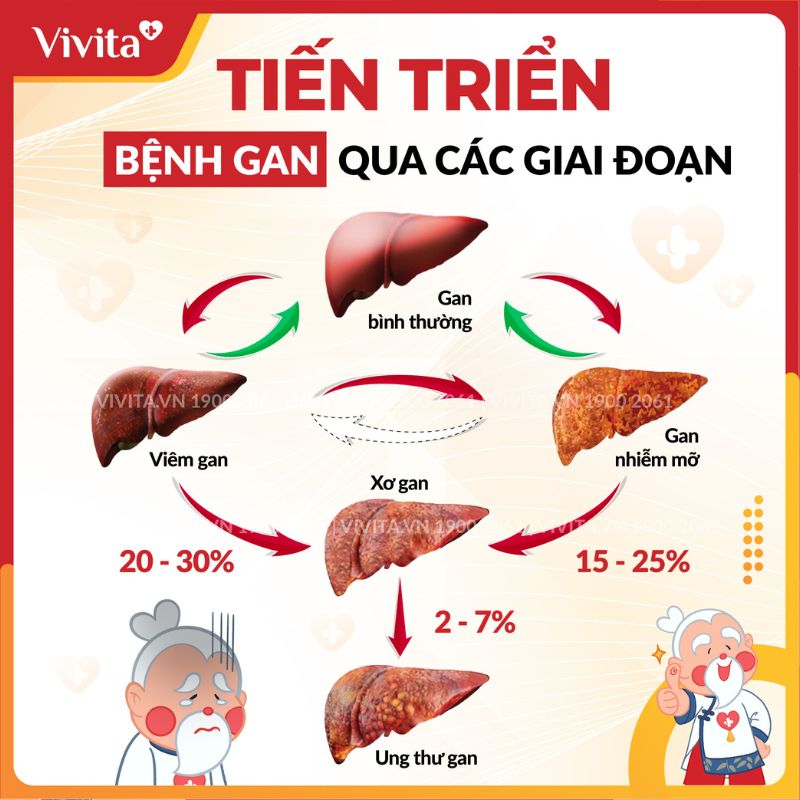 Nguy cơ ung thu Gan từ Gan Nhiễm Mỡ