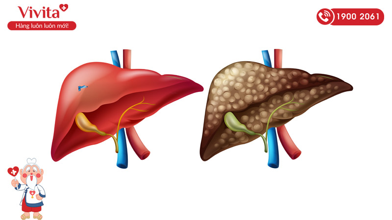 thuốc thải độc gan Detox