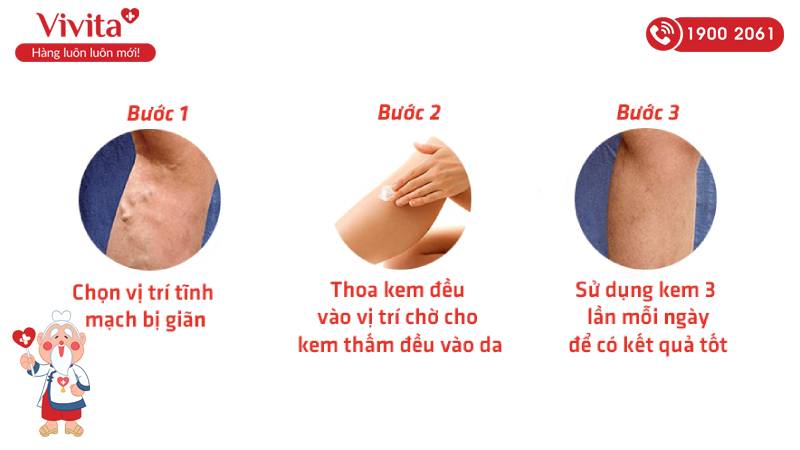 Hướng dẫn sử dụng thuốc bôi giãn tĩnh mạch