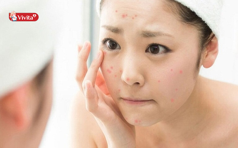 Những lưu ý khi uống collagen cho phụ nữ