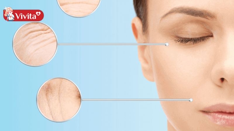 Viên uống Collagen mang đến nhiều lợi ích cho sức khoẻ, nhất là chống lão hoá