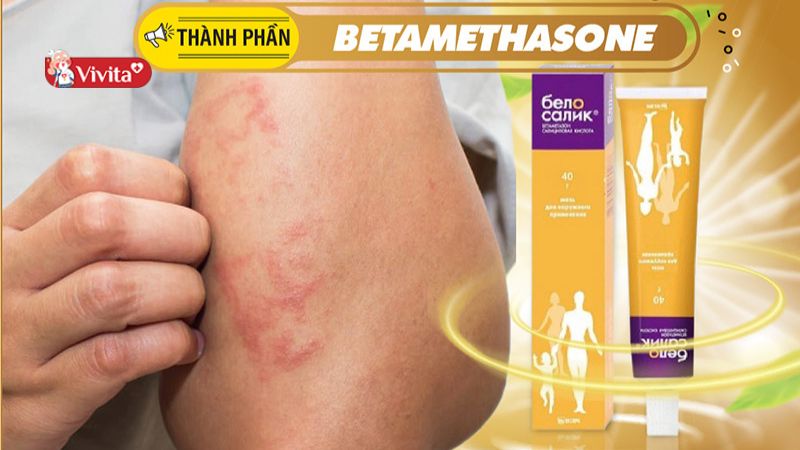 Thành phần trong kem Belosalic