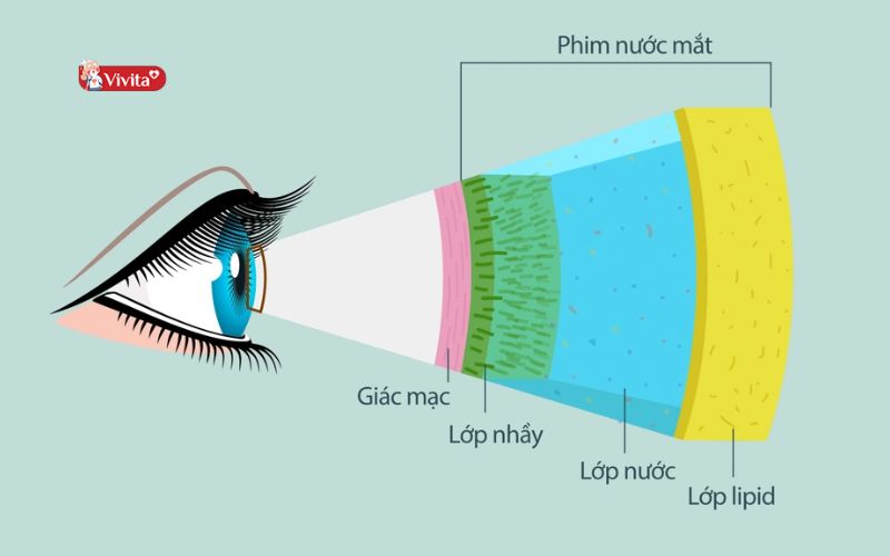 Nguyên nhân gây ra chứng khô mắt