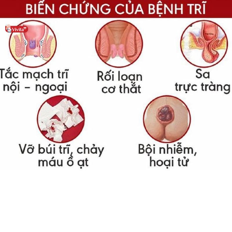 biến chứng của bệnh trĩ