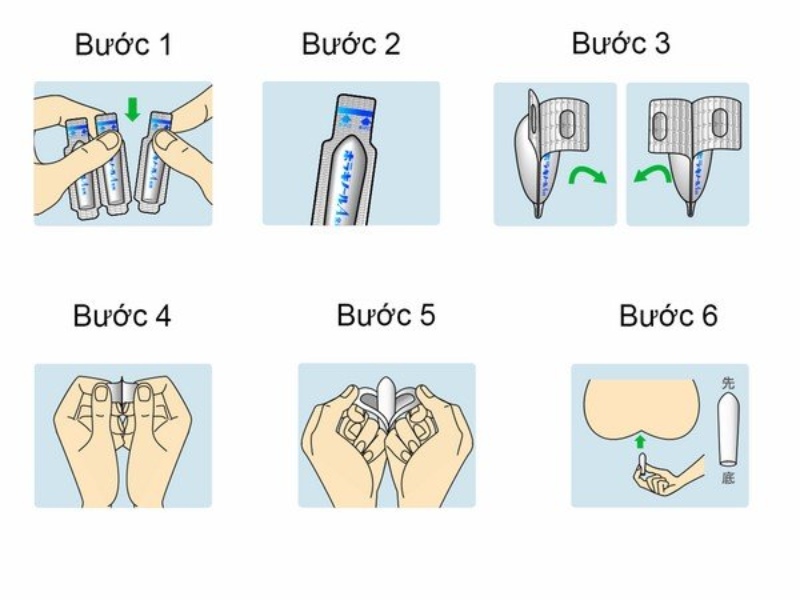 Cách đặt thuốc trĩ vào hậu môn