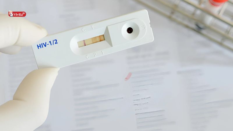 Giới thiệu que test HIV