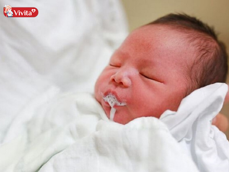 Hệ tiêu hóa chưa hoàn thiện là một trong những nguyên nhân khiến trẻ dễ gặp tình trạng nôn trớ, trào ngược trong những năm tháng đầu đời