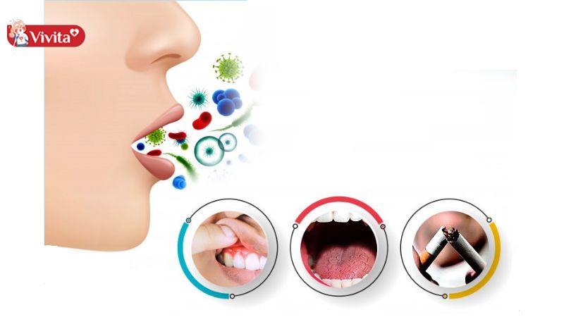 cách điều trị hôi miệng